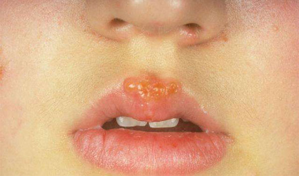 �촽�ϳ�����ô�� �촽�ϳ��ݸ���λ���